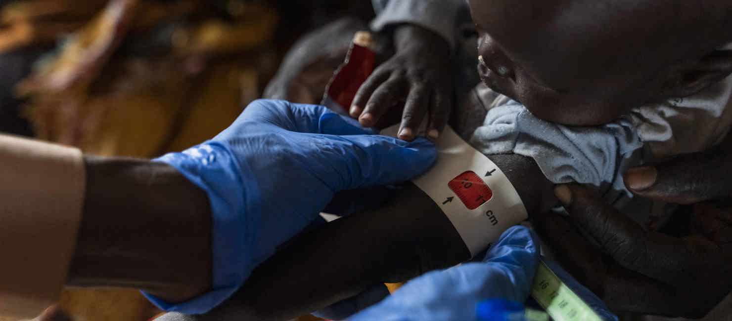 A health worker conducts an arm band test to check for malnutrition among children at a camp in Sudan