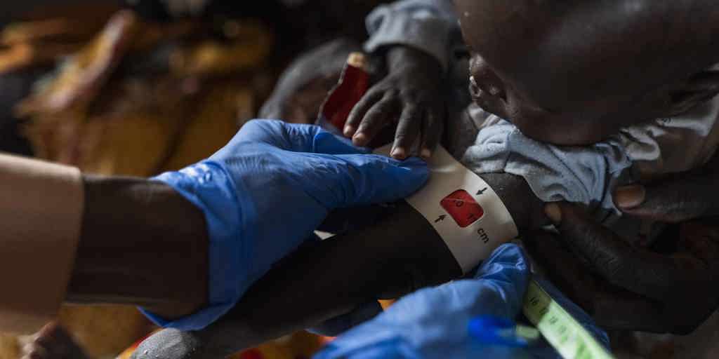 A health worker conducts an arm band test to check for malnutrition among children at a camp in Sudan